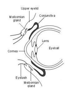 Diagram of an eye showing areas that are affected by Posterior Blepharitis
